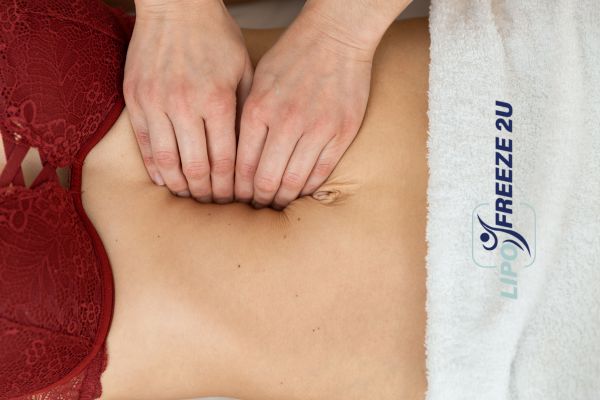 diastasis recti treatment Ascot