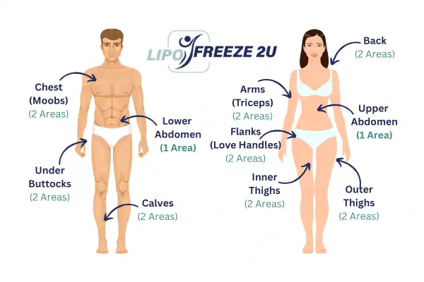 Areas you can have fat freezing treatment Ascot