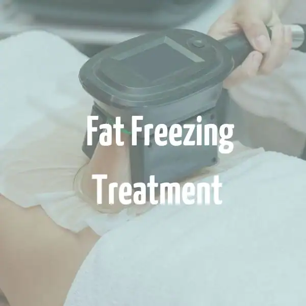 fat freezing treatment Ascot